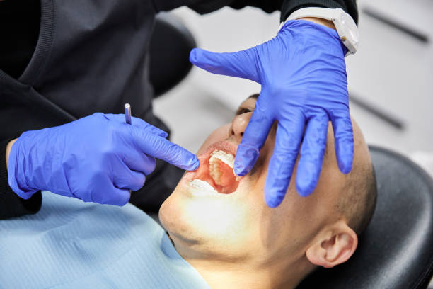 Best Knocked-Out Tooth Emergency  in Shelton, CT