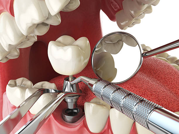 Emergency Gum Pain Relief in CT
